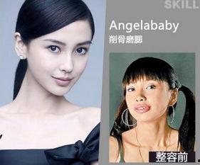 梅州整容爆料案件最新